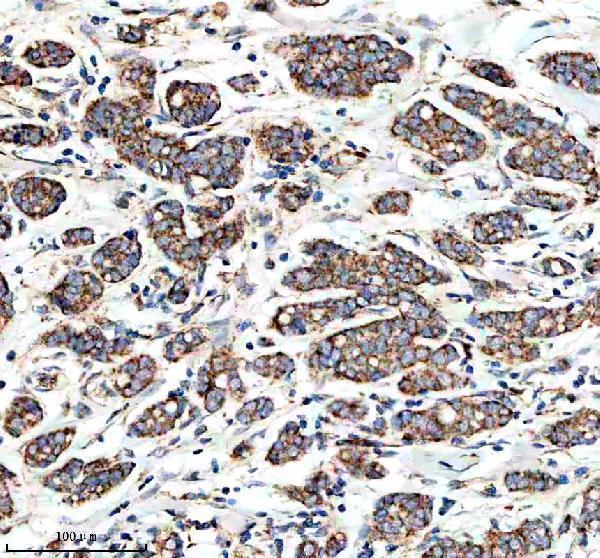 IHC analysis of NDUFA10 using anti-NDUFA10 antibody (A10517-1)