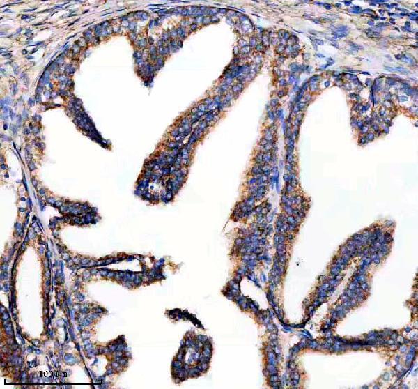 IHC analysis of NDUFA10 using anti-NDUFA10 antibody (A10517-1)