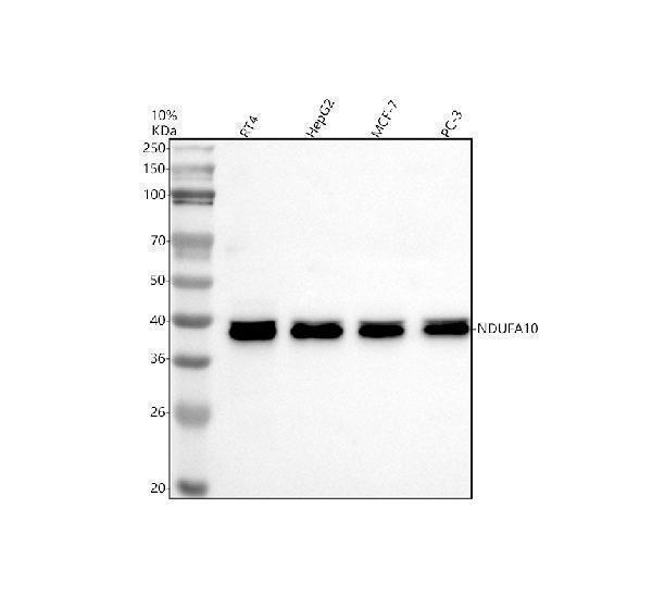Western blot analysis of NDUFA10 using anti-NDUFA10 antibody (A10517-1)