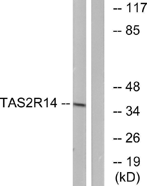 a10520 tas2r14 primary antibodies wb testing 3