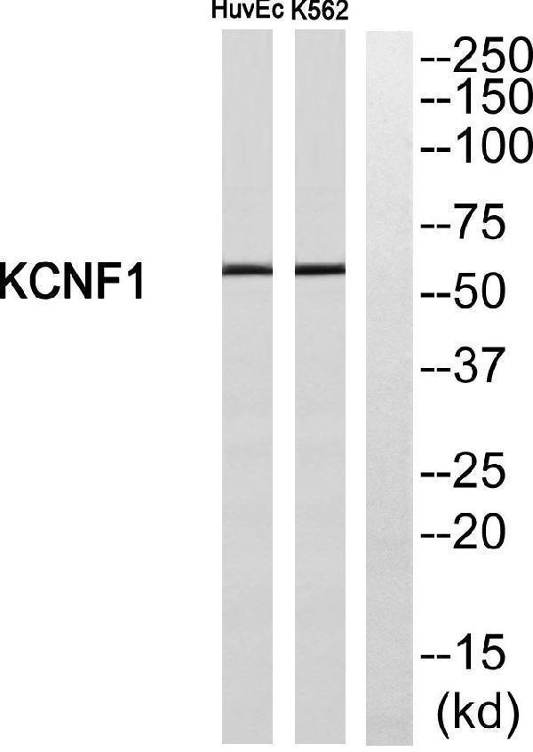 Western blot analysis of KCNF1 Antibody