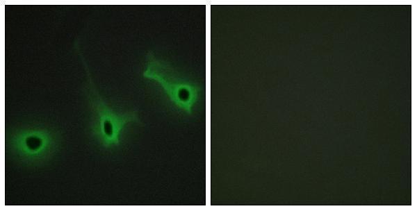 a10525 col5a3 primary antibodies if testing 1