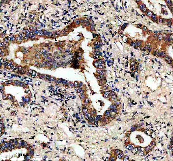 IHC analysis of FAM162A using anti-FAM162A antibody (A10534-1)