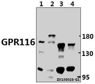 a10539 1 adgrf5 primary antiboties wb testing 1