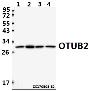 Western blot (WB) analysis of OTUB2 polyclonal antibody at 1:500 dilution
Lane1:HepG2 whole cell lysate(40ug)
Lane2:SGC7901 whole cell lysate(40ug)
Lane3:AML-12 whole cell lysate(40ug)
Lane4:H9C2 whole cell lysate(40ug)