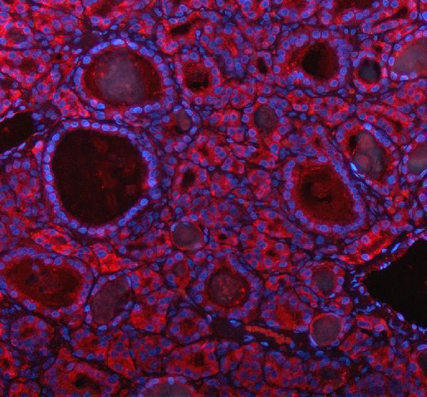 IF analysis of PARP16 using anti-PARP16 antibody (A10545-1)