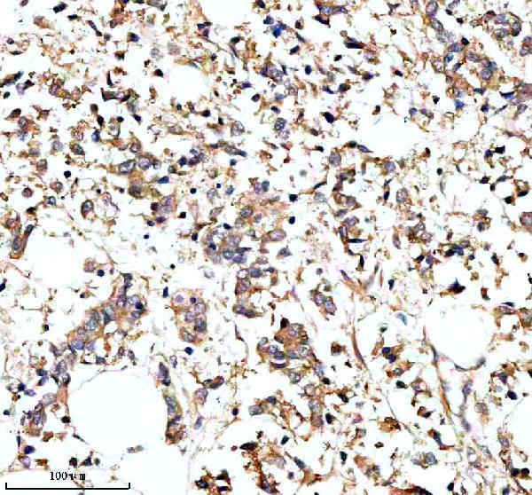 IHC analysis of PARP16 using anti-PARP16 antibody (A10545-1)