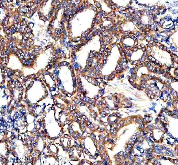 IHC analysis of PARP16 using anti-PARP16 antibody (A10545-1)