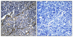 Immunohistochemistry validation of COL19A1 using Anti-Collagen alpha-1(XIX) chain COL19A1 Antibody (A10551-1)