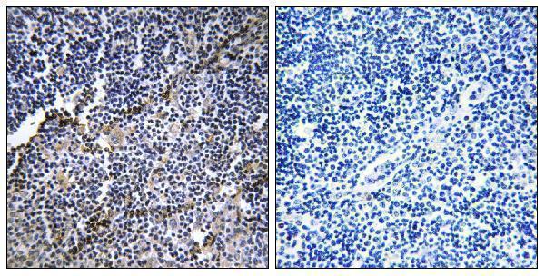 Immunohistochemistry analysis of paraffin-embedded human thymus gland tissue, using Collagen XIX alpha1 Antibody