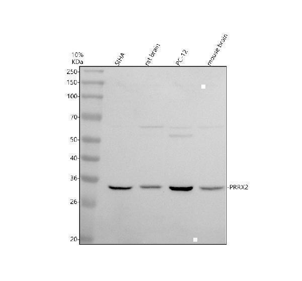 Western blot analysis of PRRX2 using anti-PRRX2 antibody (A10558-1)