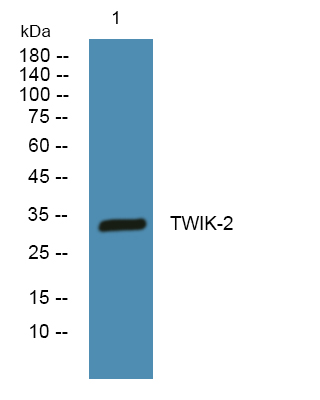 Western blot analysis of lysates from DU145 cells, primary antibody was diluted at 1:1000, 4°over night