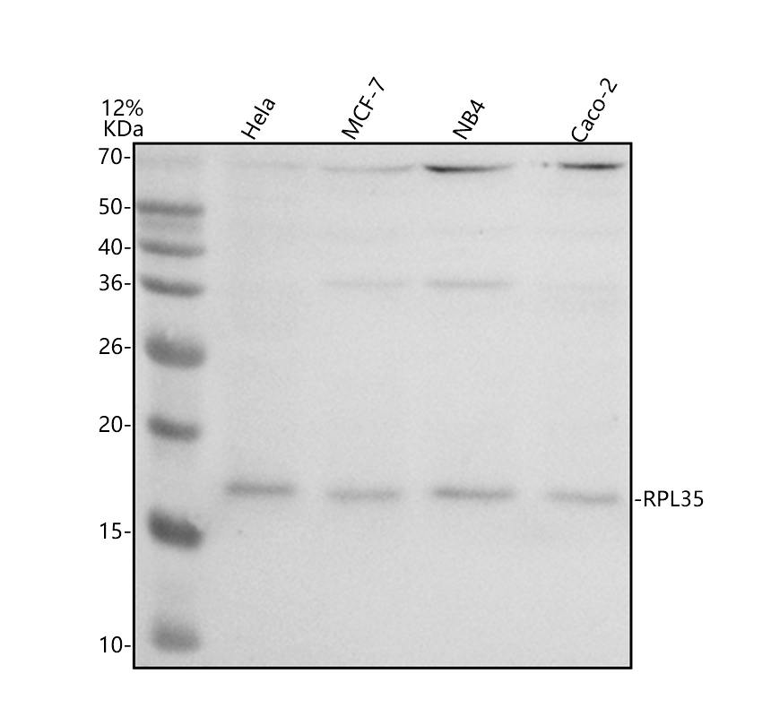 a10561 2 rpl35 primary antibodies wb testing 1