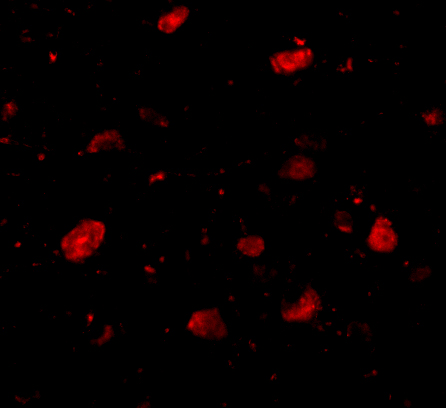a10564 slitrk5 primary antibodies if testing 3