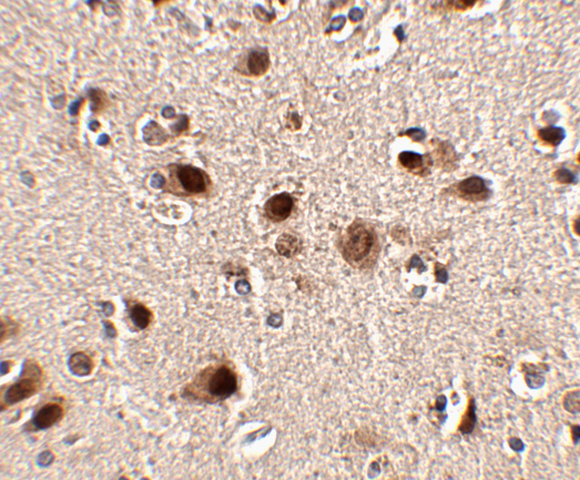a10564 slitrk5 primary antibodies ihc testing 2