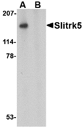 a10564 slitrk5 primary antibodies wb testing 1