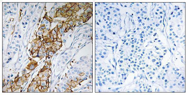 a10571 1 usp32 primary antibodies ihc testing 1