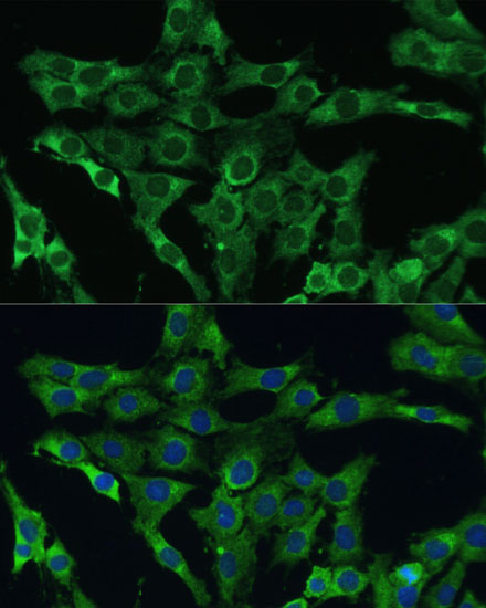 a10575 plscr3 primary antiboties if testing 2