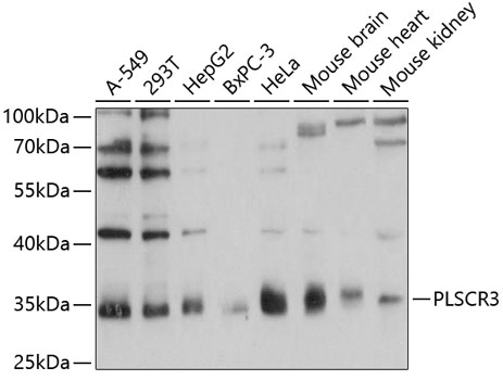 a10575 plscr3 primary antiboties wb testing 1