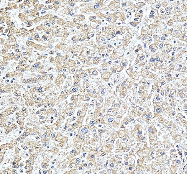 IHC analysis of STARD10 using anti-STARD10 antibody (A10577-1)