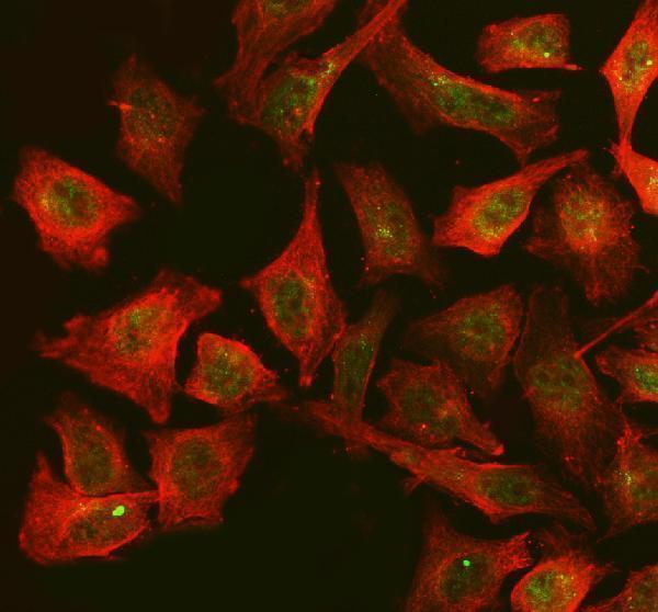  IF analysis of FAM29A/HAUS6 using anti-FAM29A/HAUS6 antibody (A10580-1) and anti-Beta Tubulin antibody (M01857-3)
