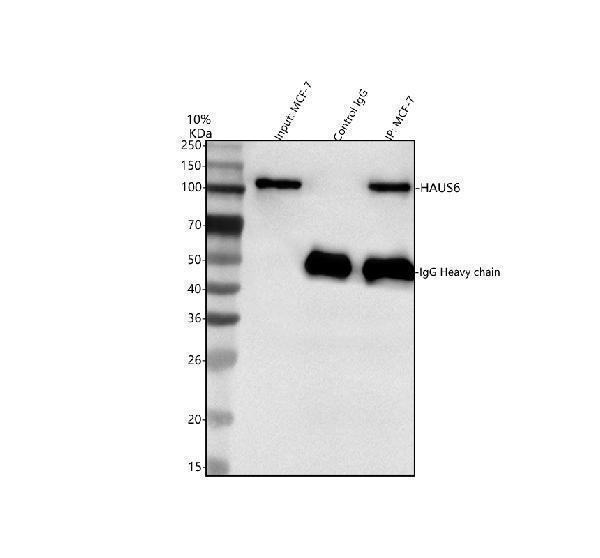  Immunoprecipitating FAM29A/HAUS6 in MCF-7 whole cell lysate