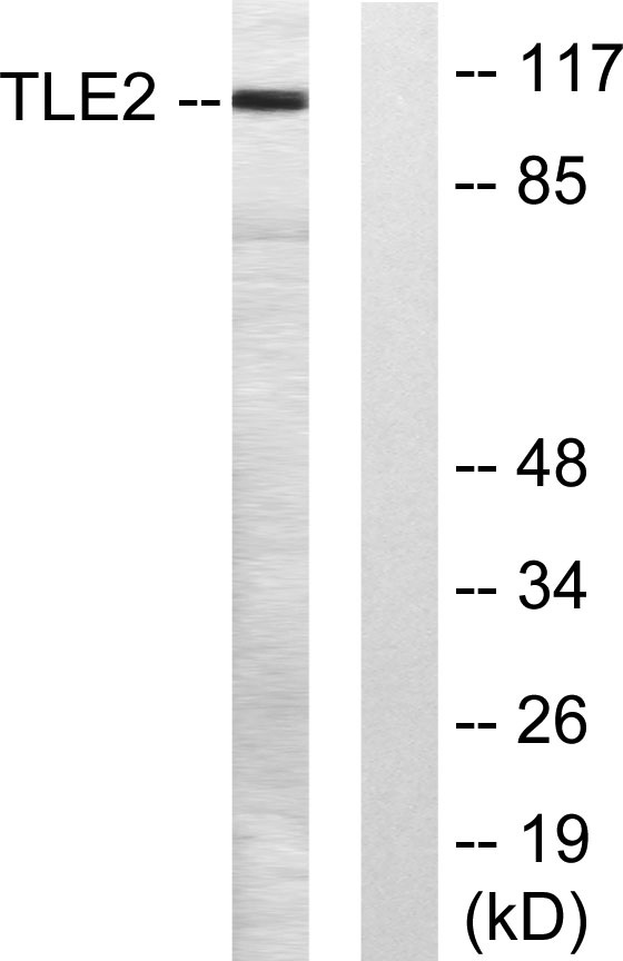 Western blot analysis of lysates from LOVO cells, using TLE2 Antibody