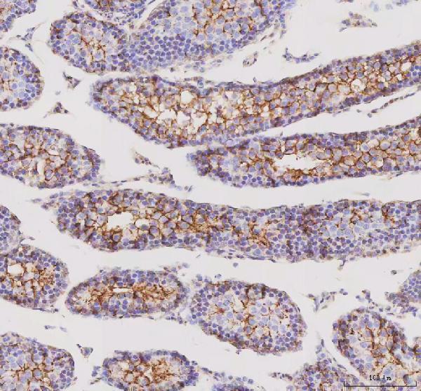 IHC analysis of STK16 using anti-STK16 antibody (A10583-1)