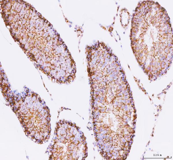 IHC analysis of STK16 using anti-STK16 antibody (A10583-1)