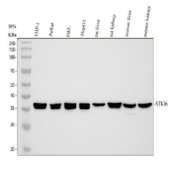  Western blot analysis of STK16 using anti-STK16 antibody (A10583-1)