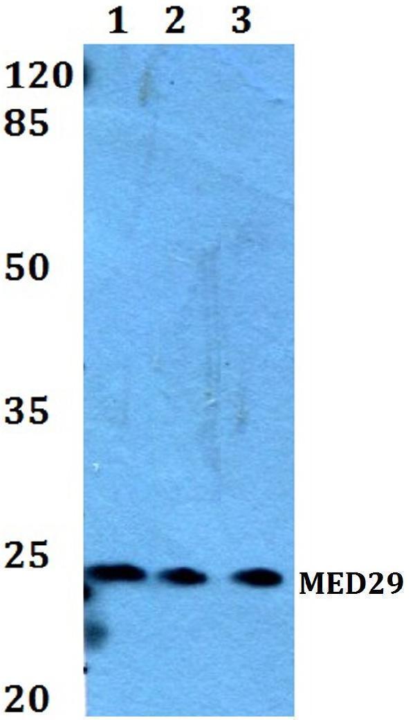 a10590 med29 primary antiboties wb testing 1