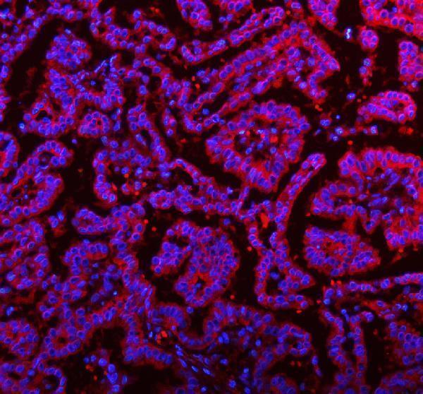 a10595 3 rnf25 primary antibodies if testing 13