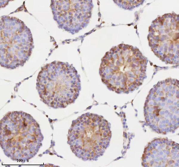 a10595 3 rnf25 primary antibodies ihc testing 11