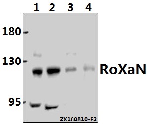 Western blot (WB) analysis of RoXaN (Q875) Antibody at 1:500 dilution
Lane1:A2780 whole cell lysate(40ug)
Lane2:Hela whole cell lysate(40ug)
Lane3:A549 whole cell lysate(40ug)
Lane4:The Lung tissue lysate of Mouse(40ug)