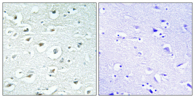 Immunohistochemistry validation of ZC3H7B using Anti-RoXaN ZC3H7B Antibody (A10596-2)