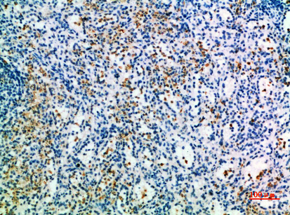Immunohistochemical analysis of paraffin-embedded human-spleen, antibody was diluted at 1:200