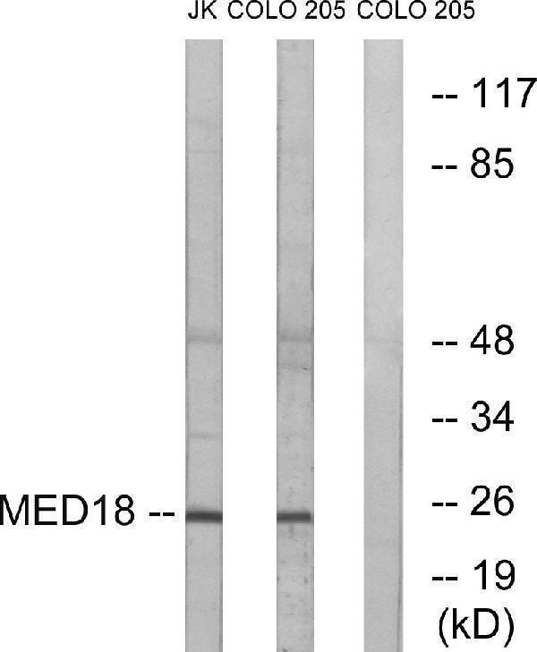 Western blot analysis of lysates from COLO and Jurkat cells, using MED18 Antibody