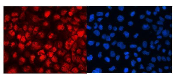a10600 2 med18 primary antibodies if testing 10
