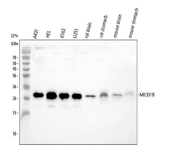 a10600 2 med18 primary antibodies wb testing 1