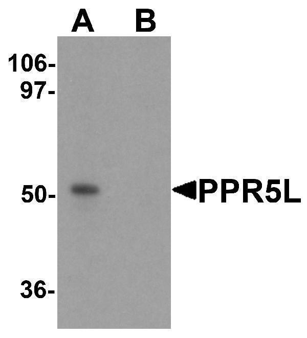 Western blot analysis of PRR5L in 3T3 cell lysate with PRR5L antibody at 1 μg/mL in (A) the absence and (B) the presence of blocking peptide