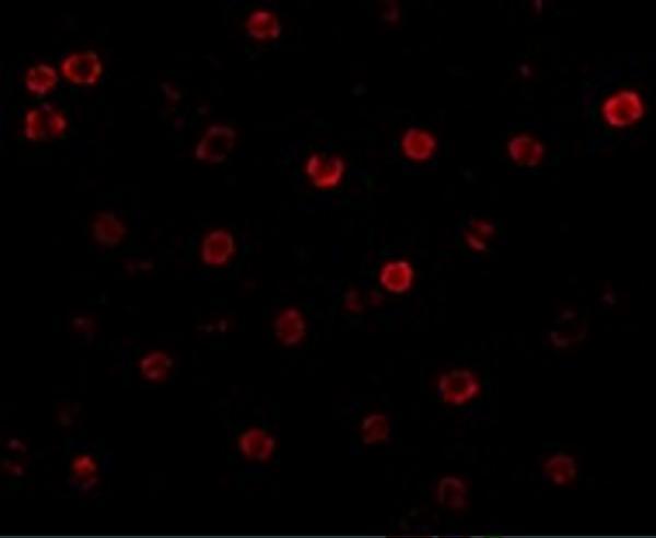 Immunofluorescence of T-cadherin in K562 cells with T-cadherin antibody at 20 μg/mL