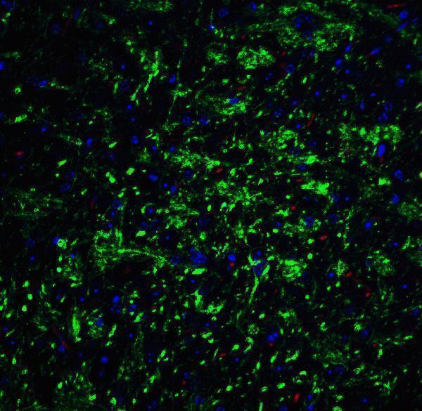 Immunofluorescence of T-cadherin in 3T3 cells with T-cadherin antibody at 2 μg/mL