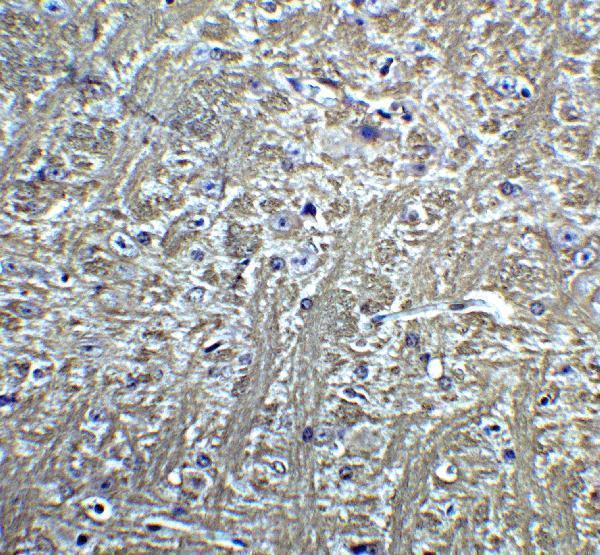 a10606 cdh13 primary antibodies ihc testing 4