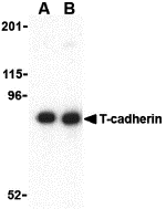 Western blot analysis of T-cadherin in 3T3 lysate with T-cadherin antibody at (A) 0