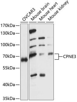 Western blot analysis of extracts of various cell lines, using CPNE3 antibody  at 1:1000 dilution