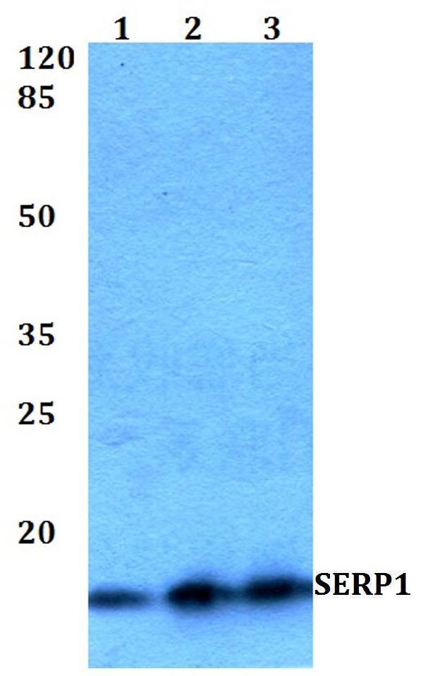 Western blot (WB) analysis of SERP1 polyclonal antibody at 1:500 dilution
Lane1:HEK293T whole cell lysate
Lane2:Raw264