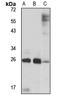 Western blot analysis of extracts of various cell lines, using LYPLA2 antibody