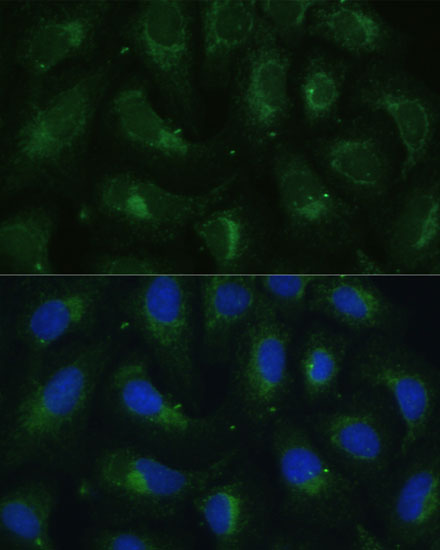 a10623 sult1c4 primary antiboties if testing 2