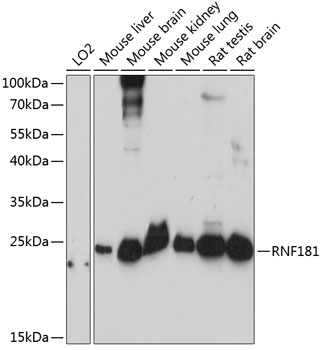 Western blot analysis of extracts of various cell lines, using RNF181 antibody  at 1:3000 dilution