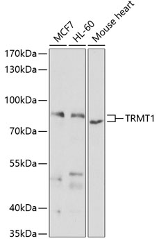 a10628 trmt1 primary antiboties wb testing 1